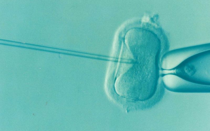 Fertile Chip para la selección de espermatozoides: ¿en qué casos se recomienda?